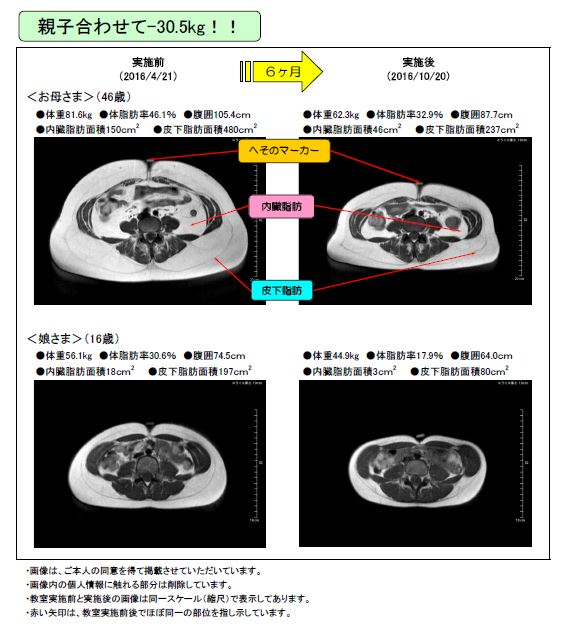 内臓 脂肪 率